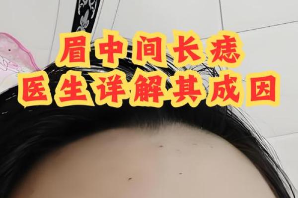 风水脸部哪里的痣不能点眉毛的痣